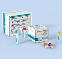 Pneumocystis jirovecii (carinii)-FL. Выявление ДНК возбудителя пневмоцистной пневмонии Pneumocystis jirovecii (carinii)